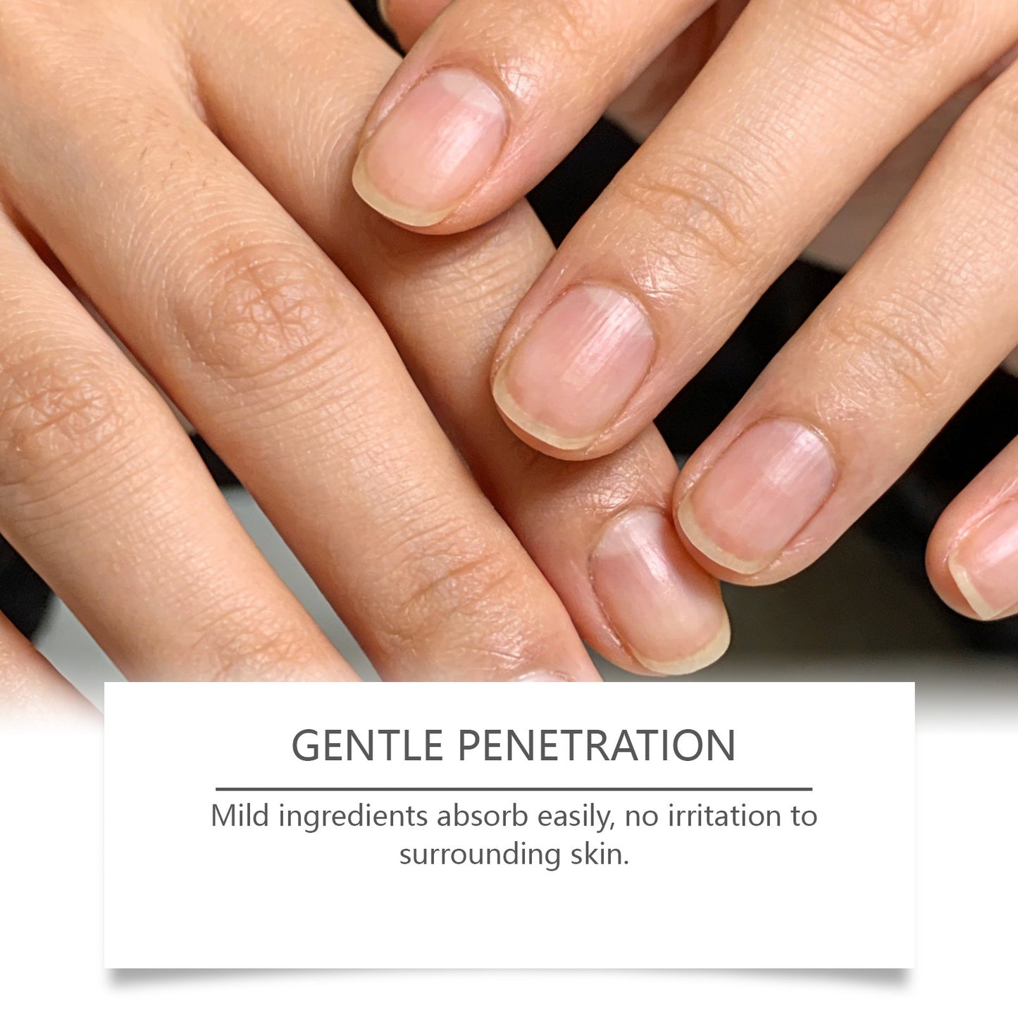 Nail Care Patches - VibeDroid